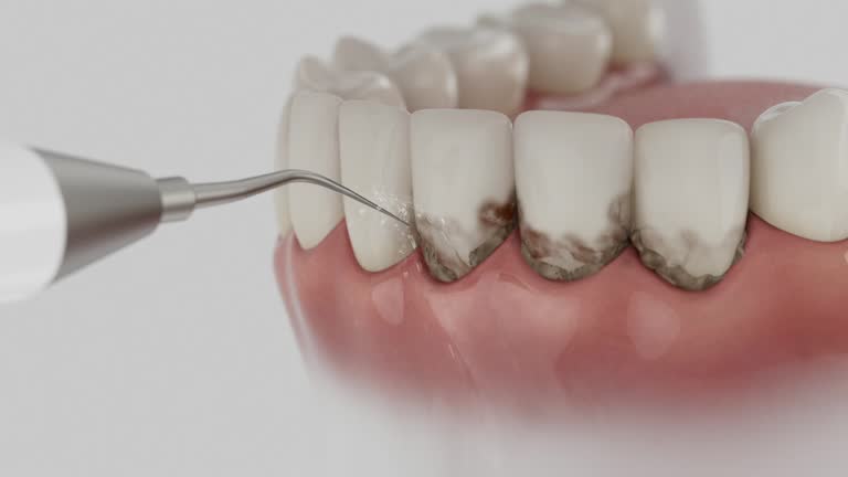 Reliable Dental Implants contractor in Baton Rouge, LA by Smile Center Dentistry